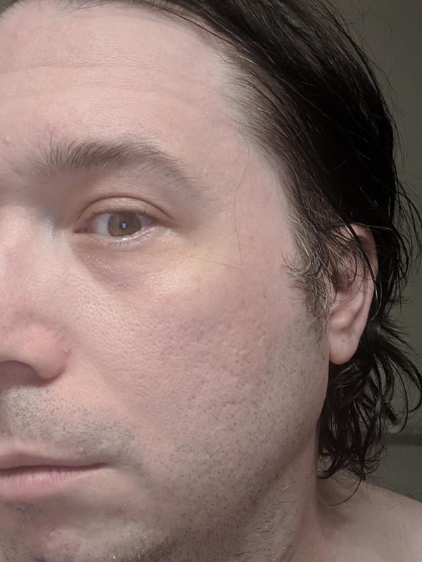 After 2 weeks...going into step 2