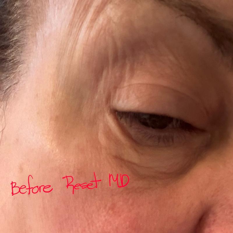 Review Thumbnail Image 1 385053235