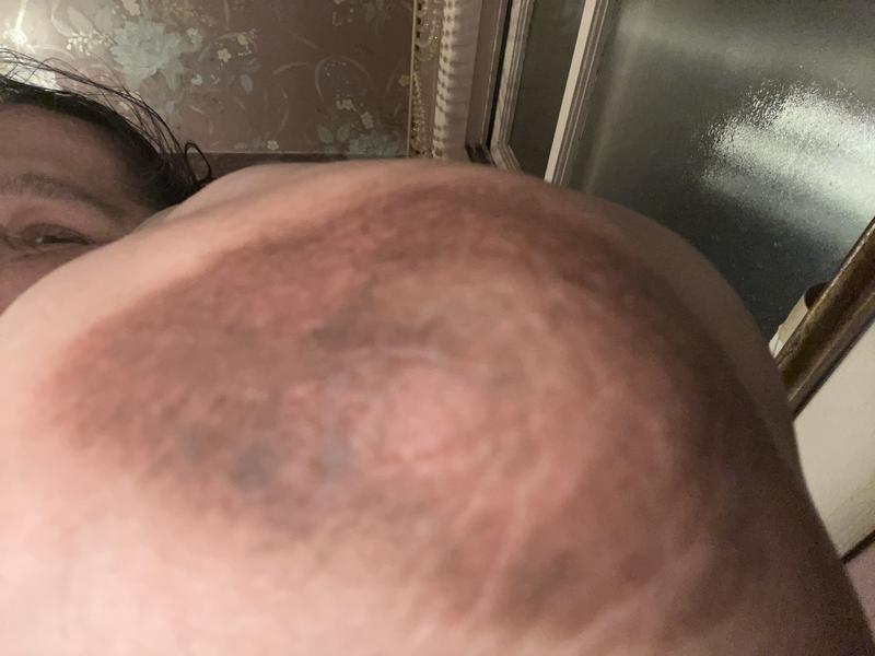 Left Elbow will submit a new one soon