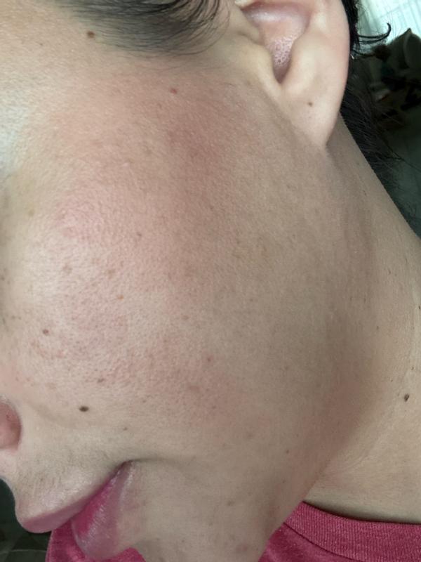 Review Thumbnail Image 0 384833229