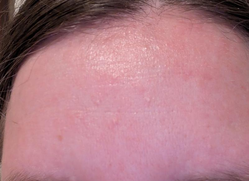 Review Thumbnail Image 1 386249634