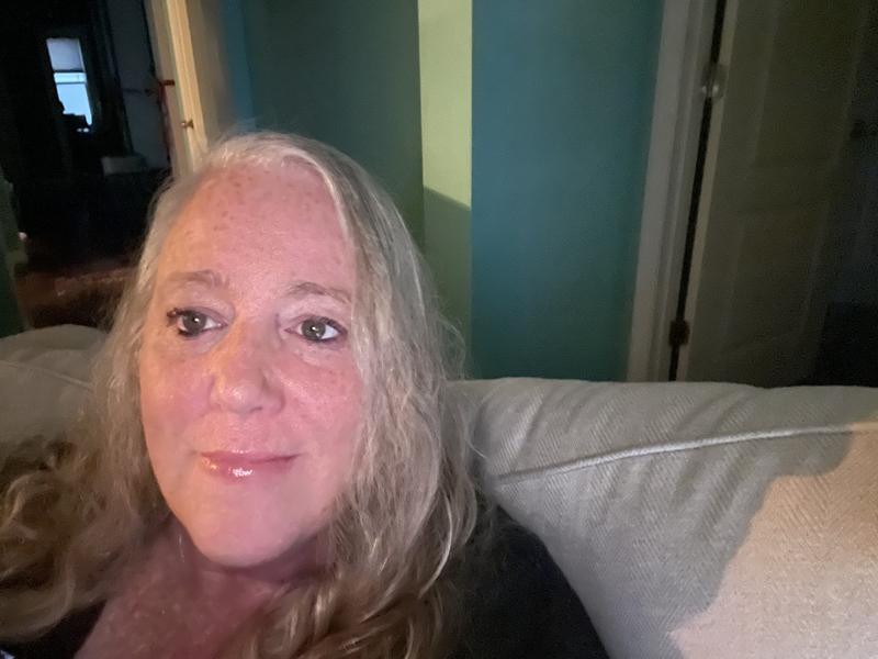 My face!