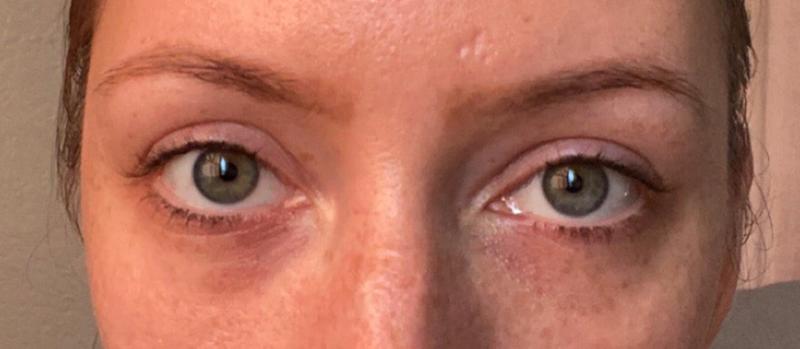 lancome progres eye cream discontinued