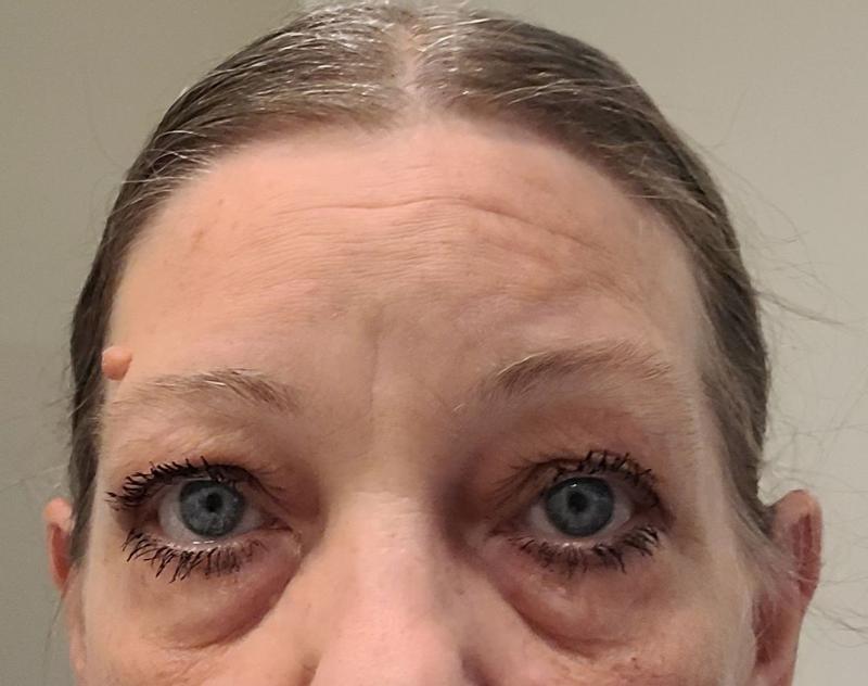 Review Thumbnail Image 1 384755599