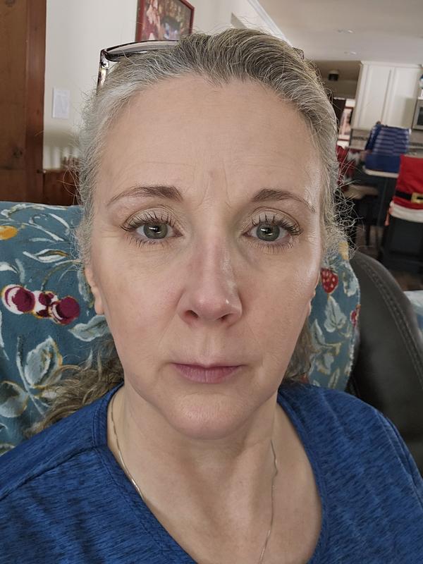 Fair, Sensitive Skin