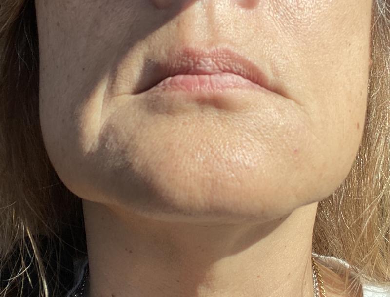 You can actually see the difference!