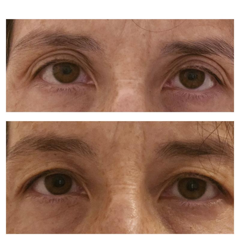 Simplh Amazing!!! This was after a couple of uses!