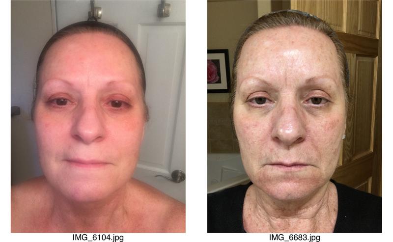 Before on the left and after on the right.