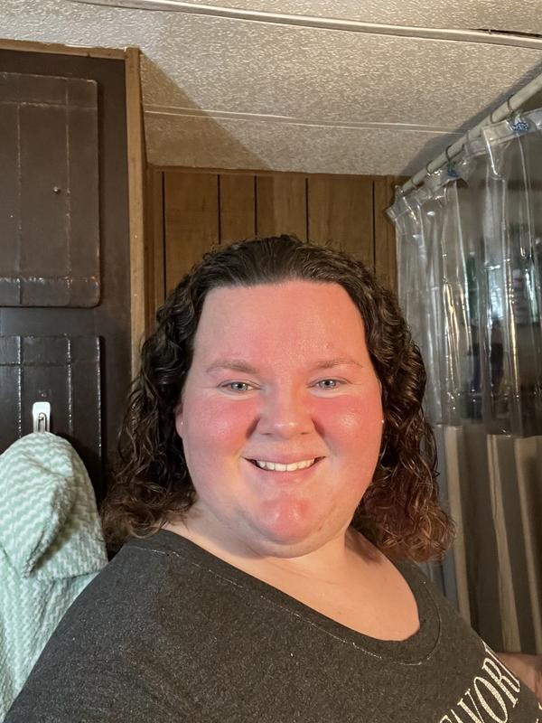 My natural face after my moisturizer and night routine. But you can see all the redness I just have!
