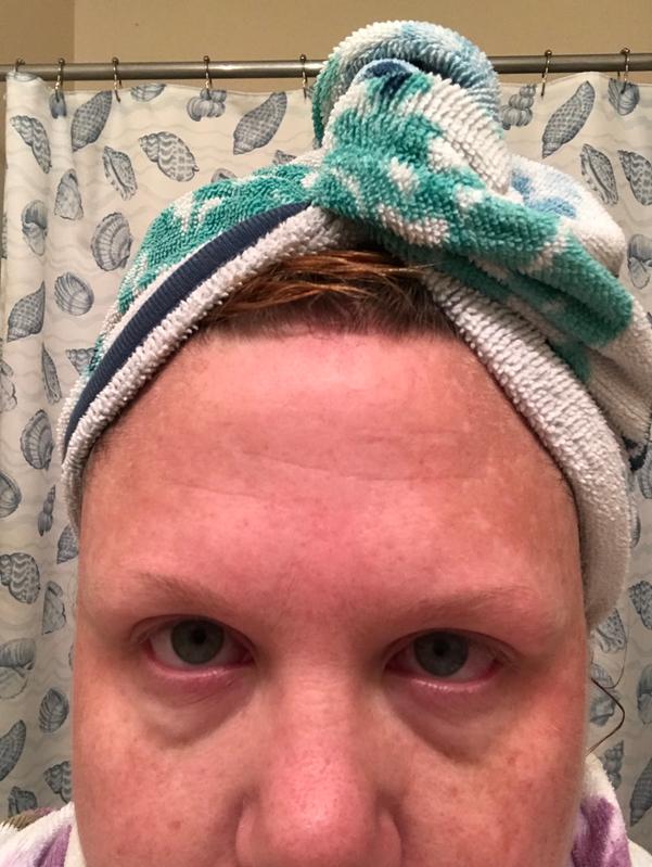 After 3 weeks of use