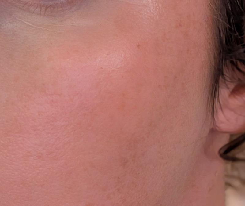 Review Thumbnail Image 0 392801624