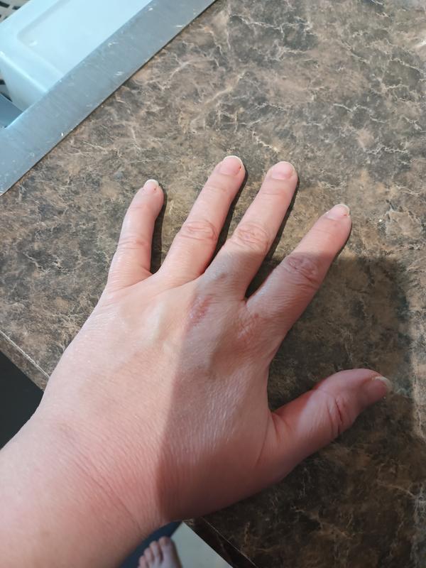 Before/after hand lotion applied