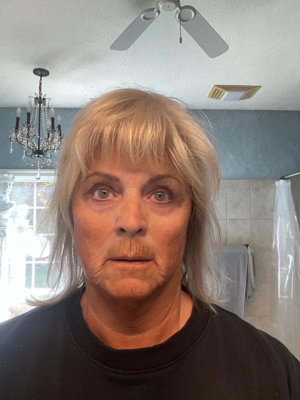 Before (L) and 4 days later (R).