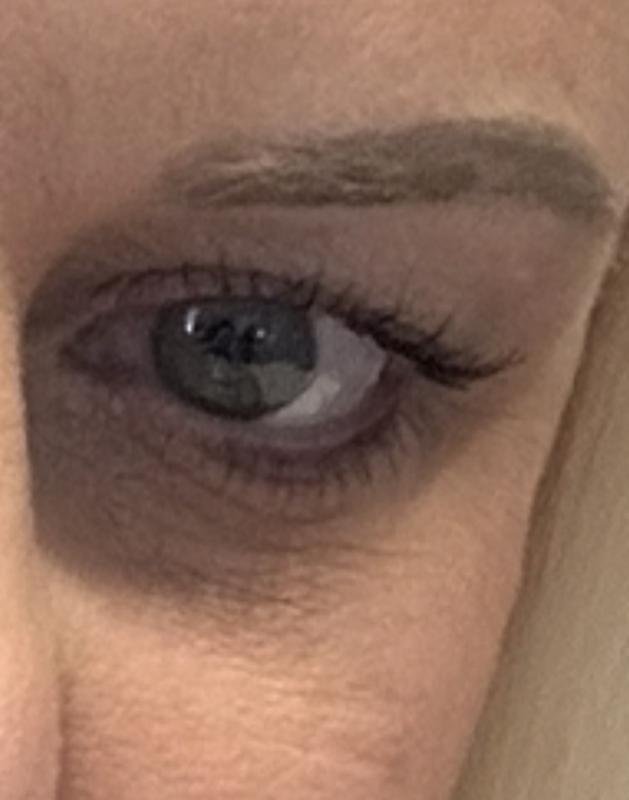 No change in eye area at all after 1 full year of twice a day use