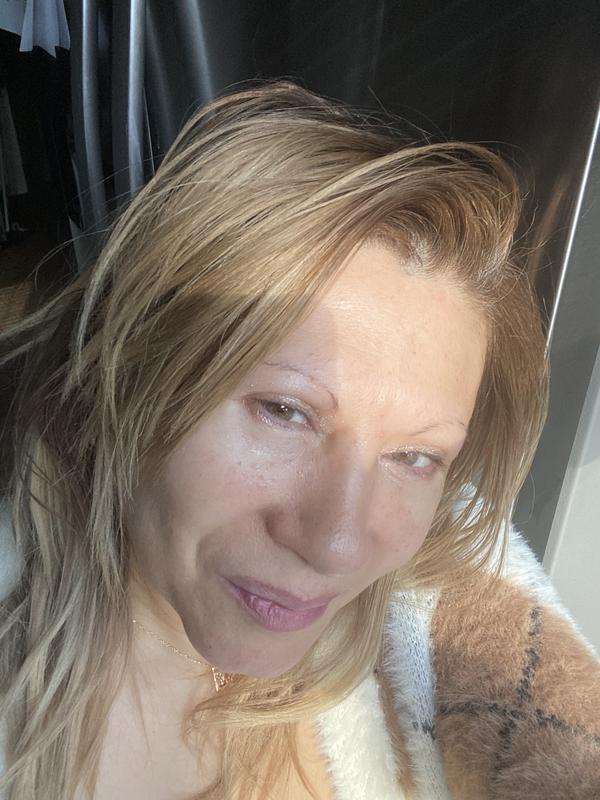 Bare skin No make up.