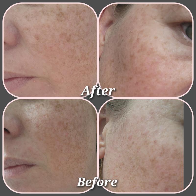 Before and After photo