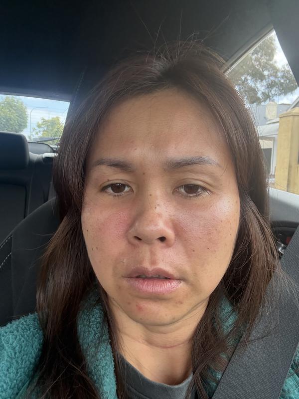 I used the product and after my face very itchy and get swollen and red . Now I’m stop using it hopefully it will help and my face willGetting better 😔