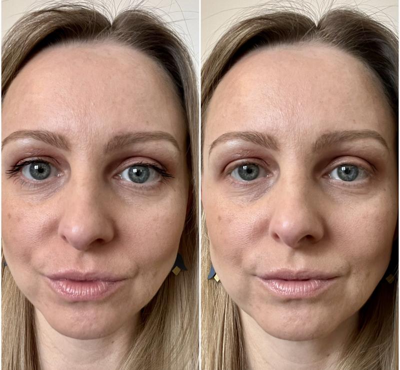 Before and After