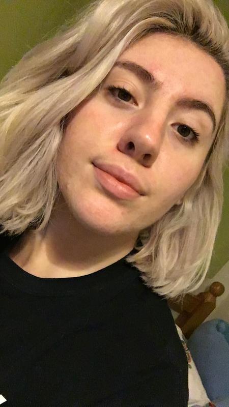 My skin after! Visibly healthier quality, reduced redness, very moisturised and happy!