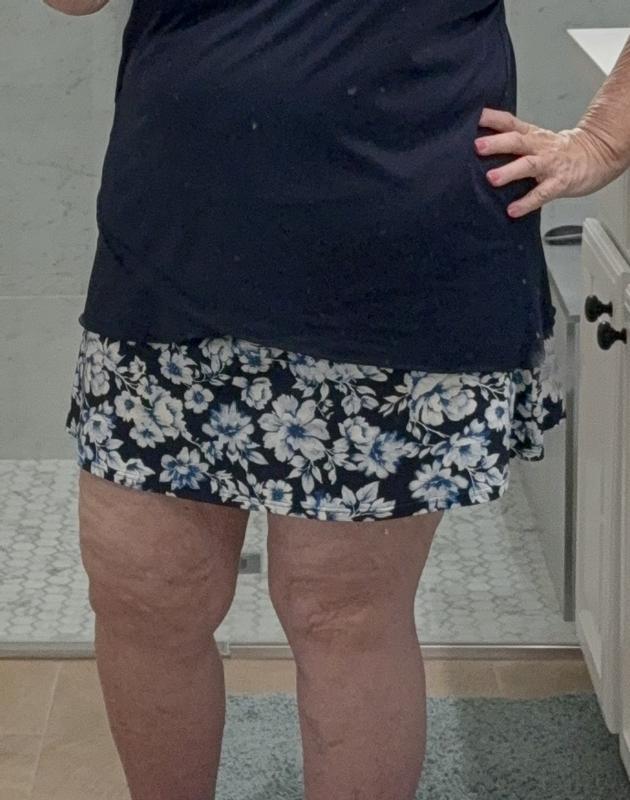 Review Thumbnail Image 0 381821703