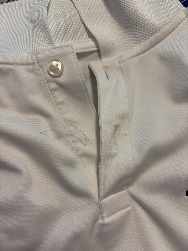 Customer photo for "Button fell off"