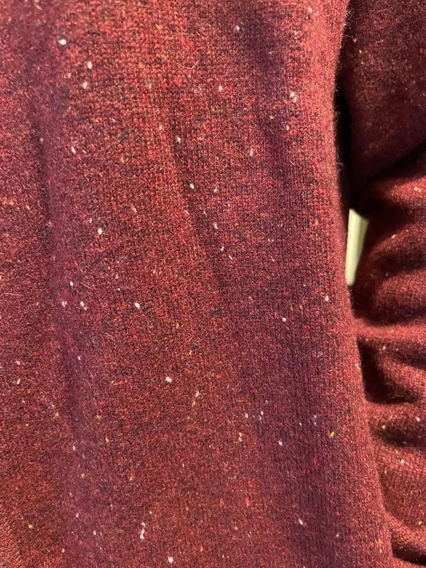 Looks like it has fuzz on it.