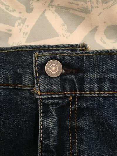 mismatch due to improper placement of button hole