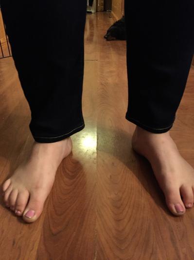 Very baggy ankle!