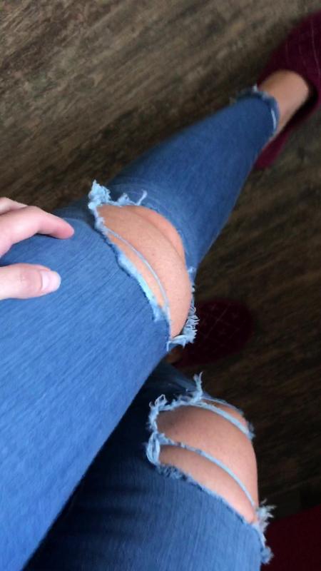 i buchi sulle ginocchia, non certo come in foto =(