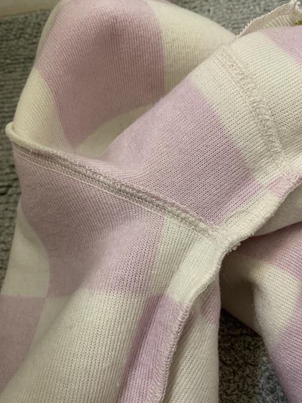 Extremely itchy seams