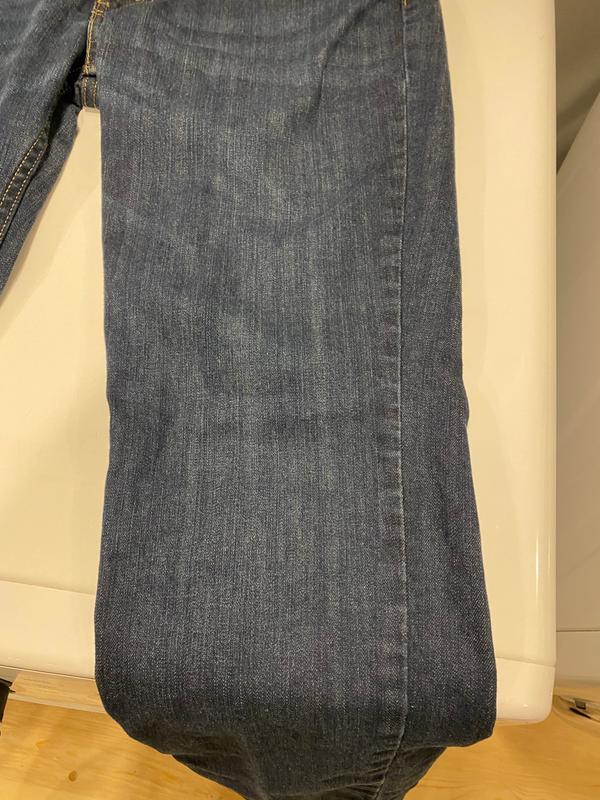 Vertical stripes on leg