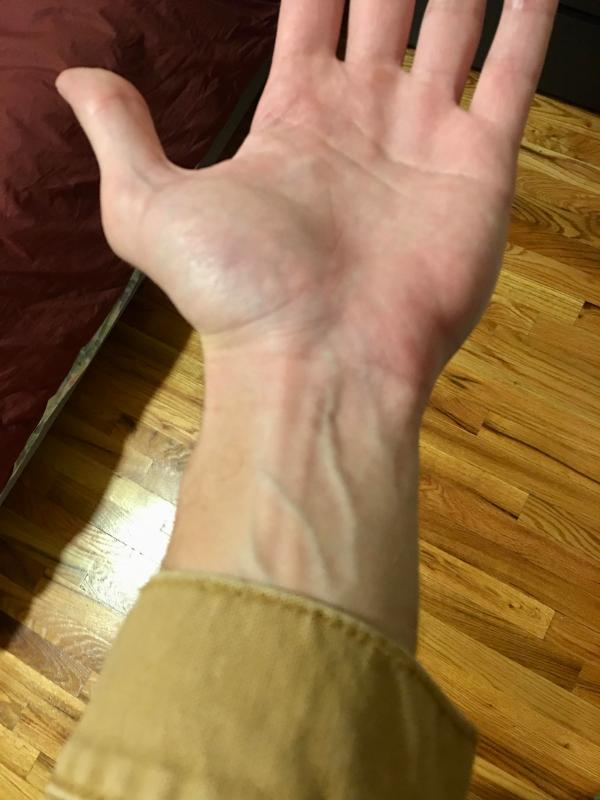 Or 5 inches more!