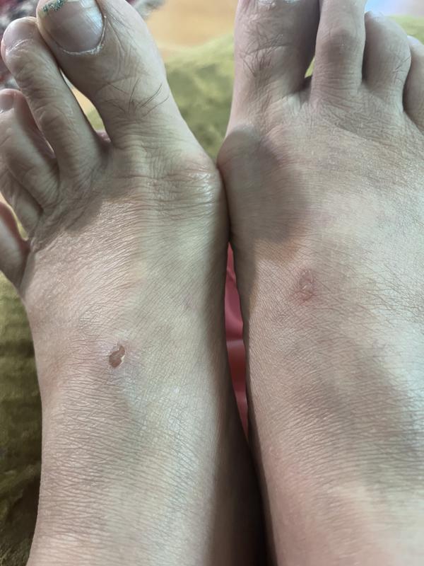 Customer photo for "Hurts"