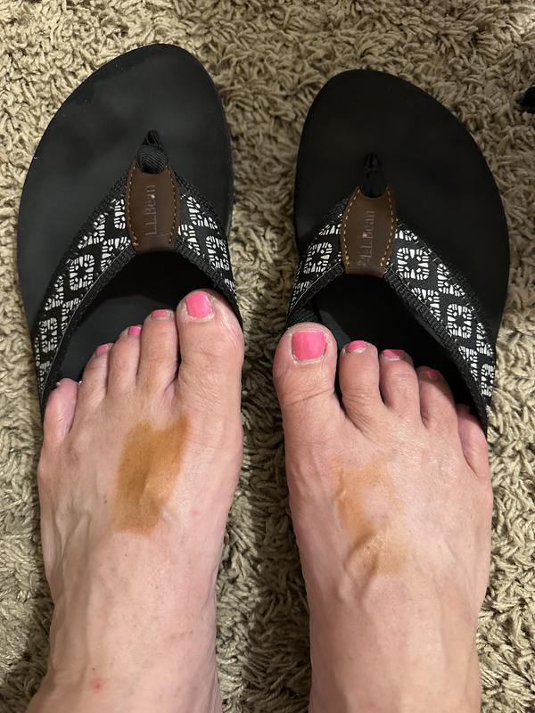 Brown stained feet because of the shoe 🥺