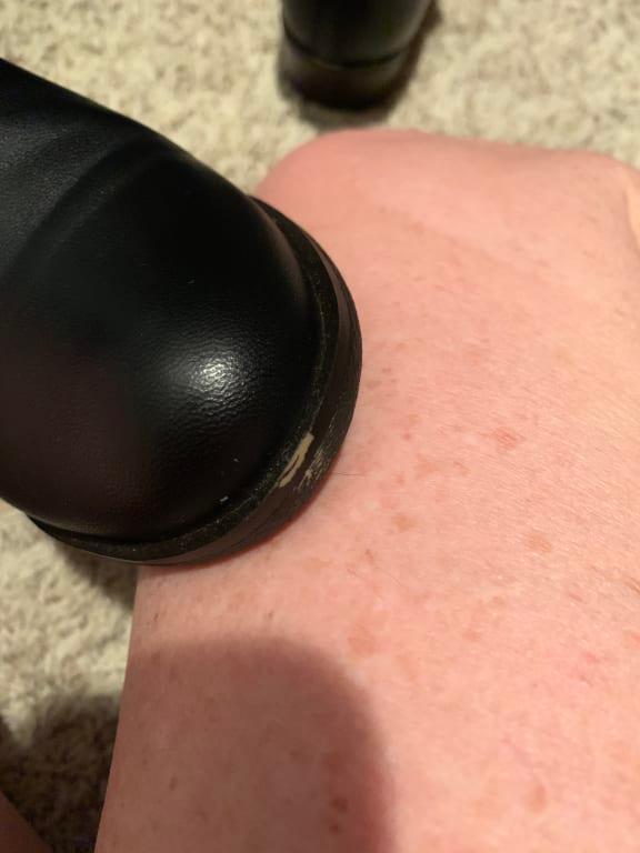 Toe paint missing in less than 2 hours