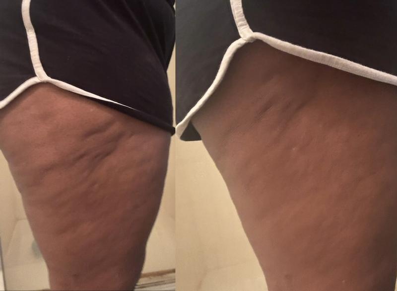 Left is before and right is 30 days after the oil