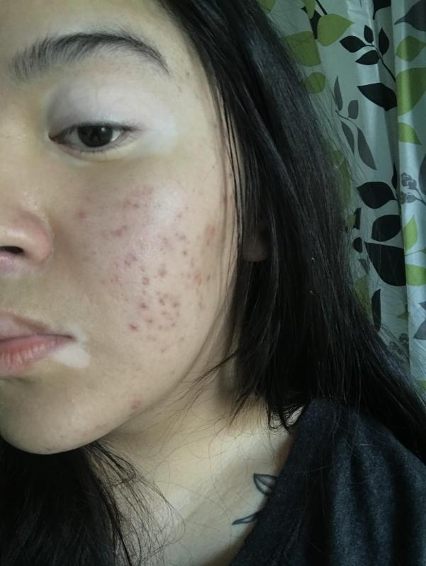 Customer photo for "Best facial cleanser I have used ever!"