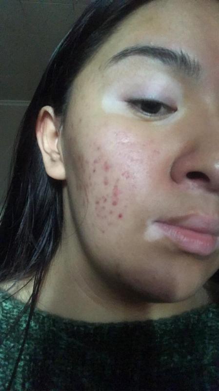 Customer photo for "Best facial cleanser I have used ever!"