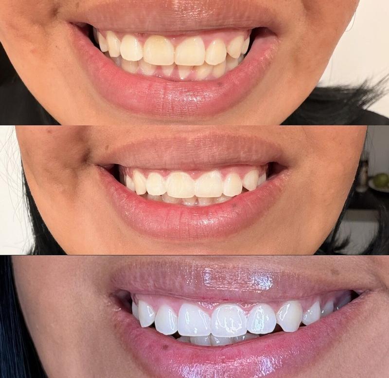 Review Thumbnail Image 0 371108741