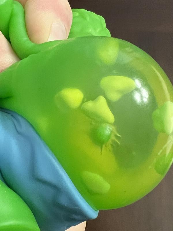 Beads inside the body.