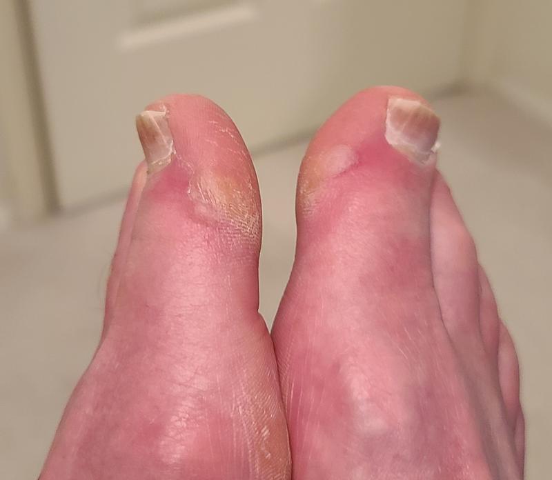 Photo submitted with review of product