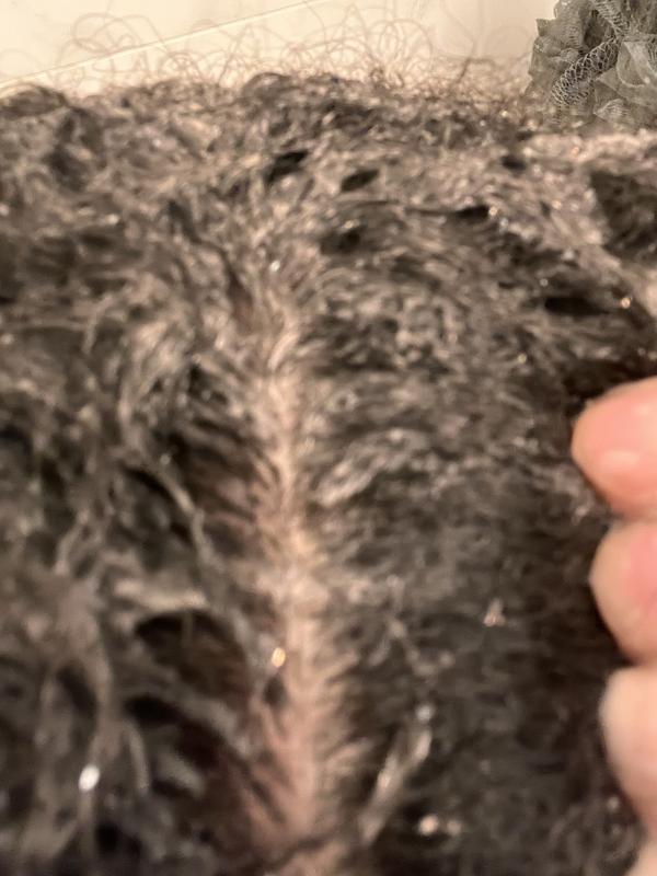 Clean scalp :)