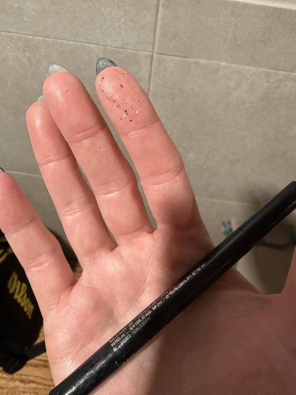 This is what flakes off on your hands and face.