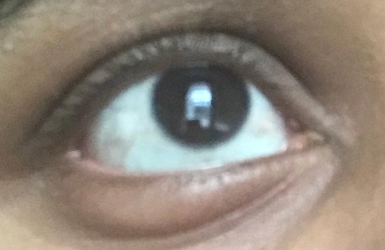 Eye swelled after using the eyeliner
