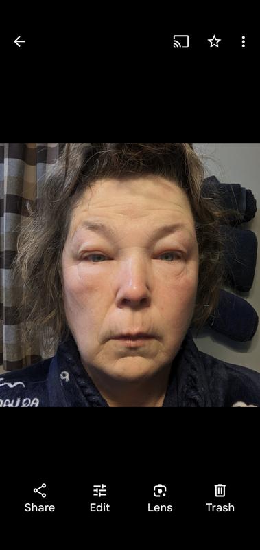 The morning after
