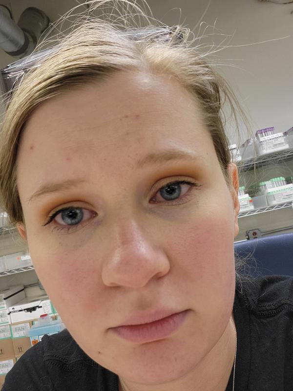 This is me after having to use the emergency eyewash station.