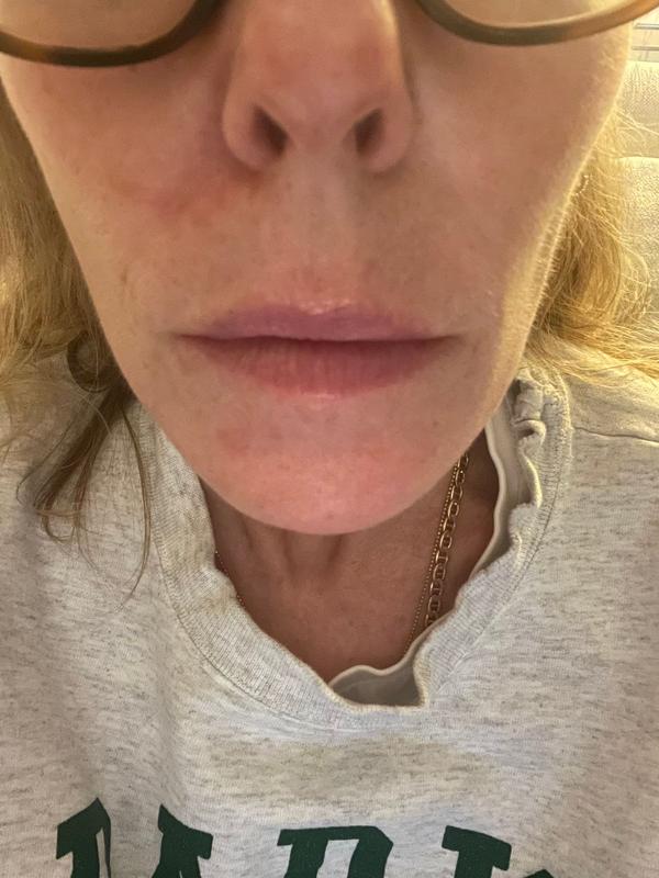 Customer photo for "so far so good!"
