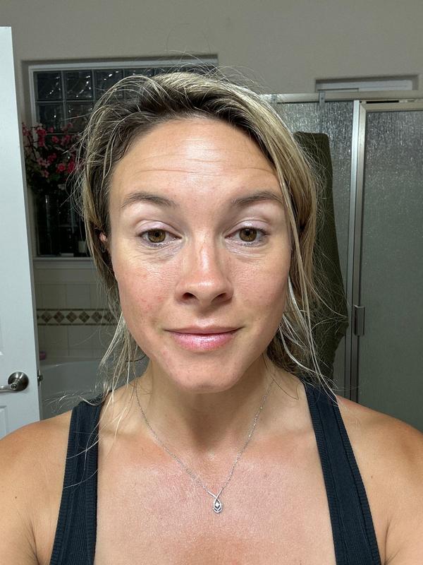 Customer photo for "Helped with my skin"