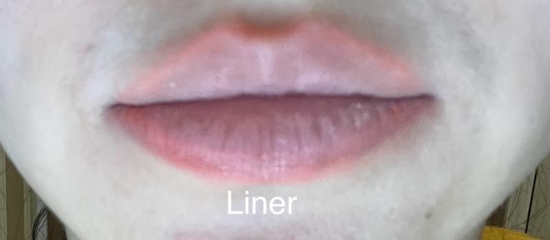 Liner