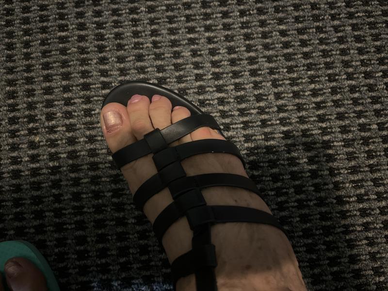 1.Right foot view little toe….”